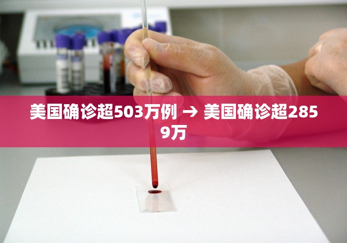 美国确诊超503万例 → 美国确诊超2859万