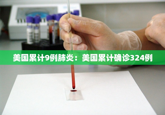 美国累计9例肺炎：美国累计确诊324例