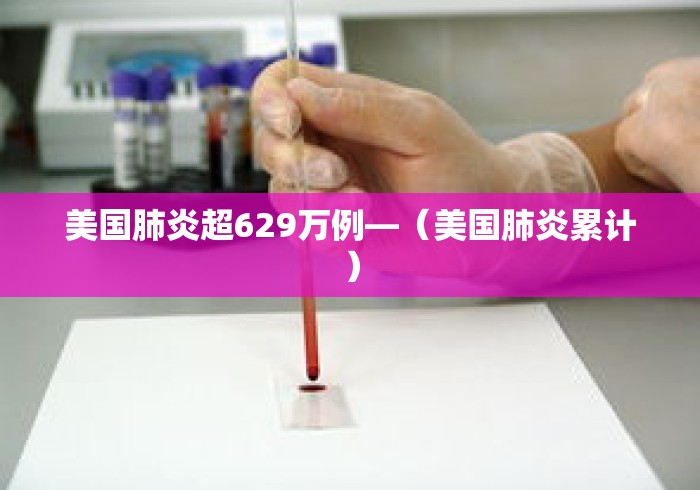 美国肺炎超629万例—(美国肺炎累计) 美国肺炎超629万例—(美国肺炎累计)